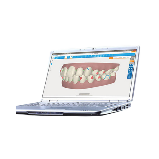 How Orthodontist-Led Consultations Reduce Risk for General Dentists Using Invisalign